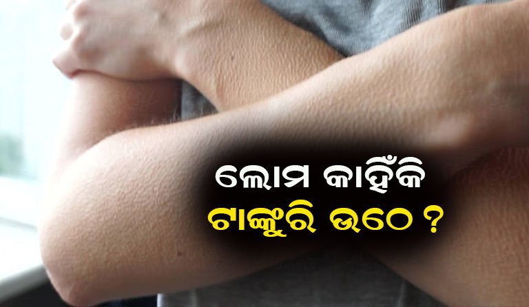 କାହିଁକି ଟାଙ୍କୁରି ଉଠେ ଲୋମ? ଜାଣନ୍ତୁ ଏହା ପଛର ବୈଜ୍ଞାନିକ କାରଣ!