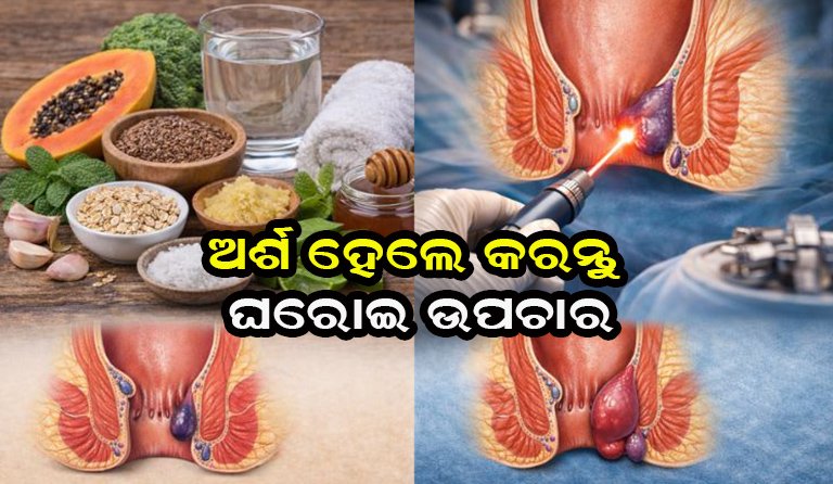 ପାଇଲ୍ସରୁ ମୁକ୍ତି ପାଇଁ ଘରୋଇ ଉପଚାର